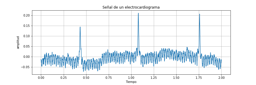 Señal de Electrocardiograma